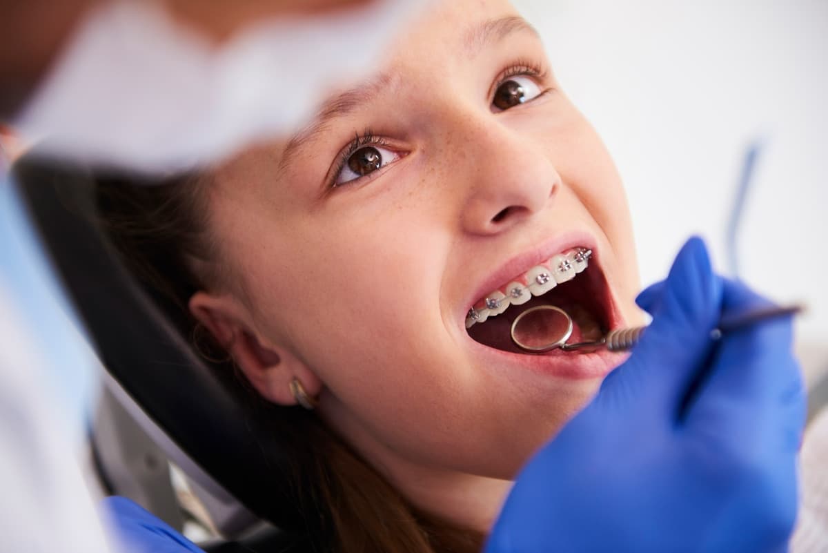 Orthodontic Treatment highlight at Miso Dental Care