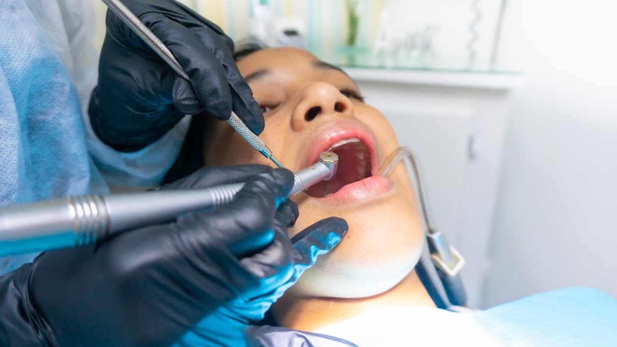 Tooth Filling highlight at Miso Dental Care
